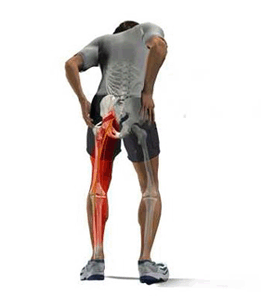 sciatica.gif
