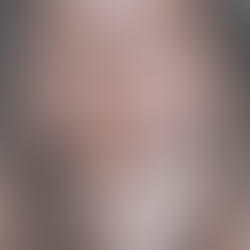 Discover Cutting-Edge Aesthetic Solutions at Estetika in São Paulo with JY Solution 🌟