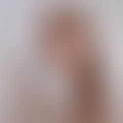 Discover how PDRN (Polydeoxyribonucleotide) supports wound healing through A2 receptor stimulation and the salvage pathway, leading to faster tissue regeneration and repair