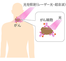 光免疫療法のメカニズム