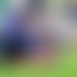 La rupture du ligament croisé antérieur (LCA) est une blessure fréquente du genou, souvent causée par un mouvement de torsion ou un traumatisme direct. Elle entraîne une instabilité, une douleur et une limitation fonctionnelle. Le diagnostic repose sur des tests cliniques comme le test de Lachman et l’IRM. Le traitement peut être conservateur ou chirurgical, avec un protocole de rééducation structuré pour retrouver force et stabilité. Découvrez les étapes essentielles de la prise en charge et les clés pour une récupération optimale sur SuperKiné.fr.