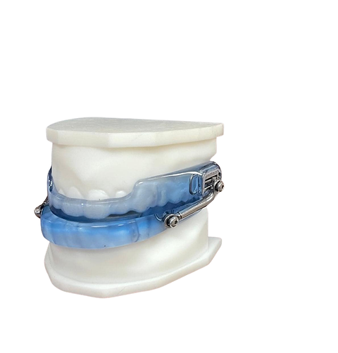 Custom oral appliance for sleep apnea treatment at Better Sleep Oklahoma Oklahoma City