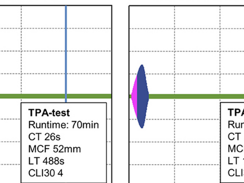 Fibrinolytic Potential