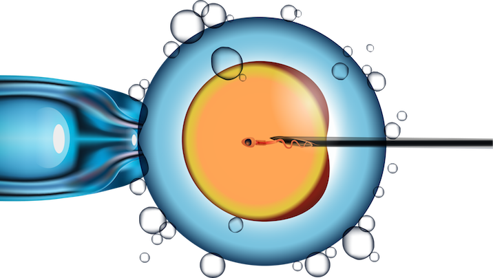 ivf-card