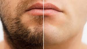sea moss for beard