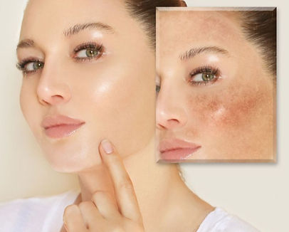 Does admire my skin work__edited.jpg