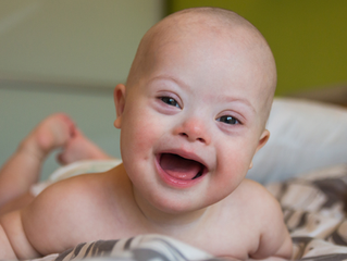 Lactancia en bebés con síndrome de Down: acompañar, comprender y sostener