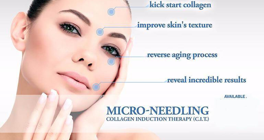 micro-needling-bonnie-hall-ink-permanent-makeup-cosmetics-south-jersey-philadelphia-MICRO-NEEDLING-P
