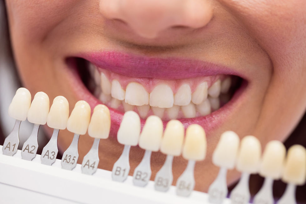 Faccette dentali