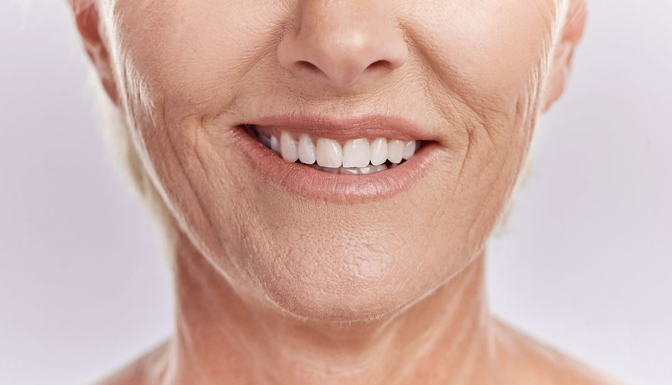 donna sorriso dentiera