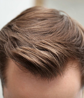 hair-loss-treatments-london.jpg