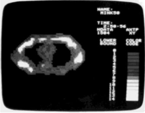 The Principles And Applications Of Magnetic Resonance: A Comprehensive ...