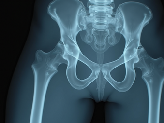 x-ray of hip discussing key findings