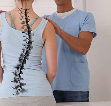 scoliosis of the spine