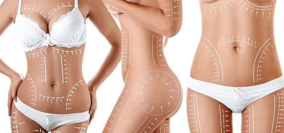 Moeller-Medical-liposuction-blog-2-banner-1600x1067px-1024x683.jpg