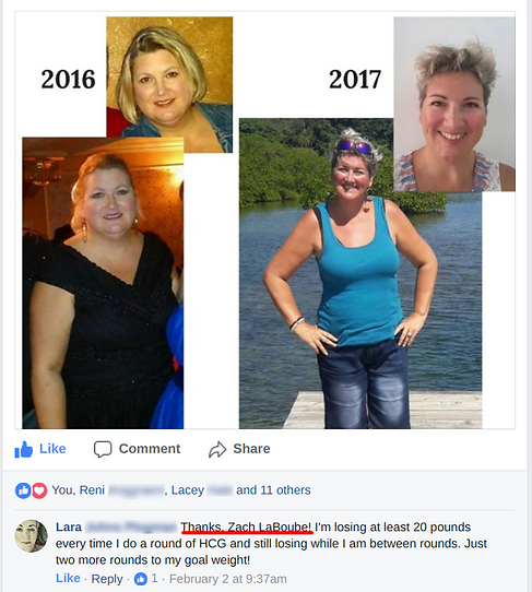 Lara lost 60 pounds with HCG 2.0 - before and after pics