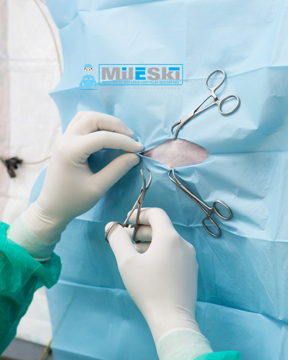 Thumbnail: Fenestrated field in SMS- Mileski®