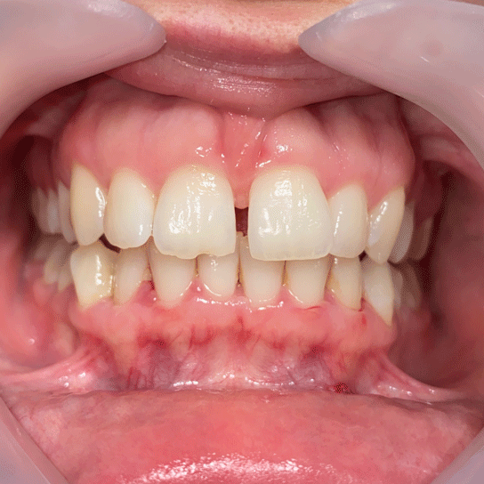 smilezor-3.gif