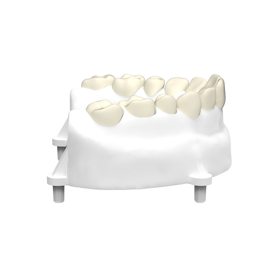 Thumbnail: Dentoform (Maxillary)