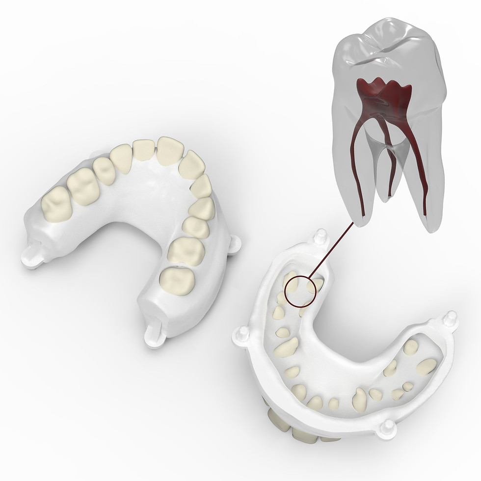 Thumbnail: Dentoform (Maxillary)
