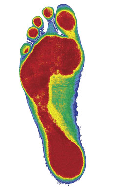 Mild Pronation