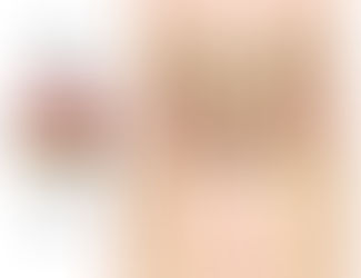 Muscle of the Month- Piriformis