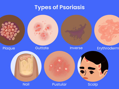 August is National Psoriasis Month: Raising Awareness and Empowering Those Affected ✨