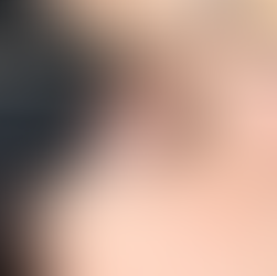 Microneedling in a Bottle: The Spicule Revolution from K-Beauty