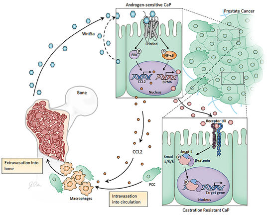 Androgen-sensitive CaP