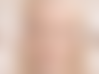 Botox vs microneedling comparison treatment