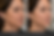 Morpheus8 before and after results