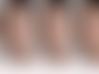 how long does botox last timeline natural results