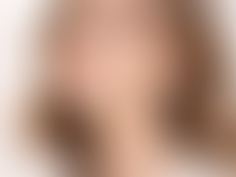 Diagram of Jawline Filler Facial Contouring on a Woman's Face