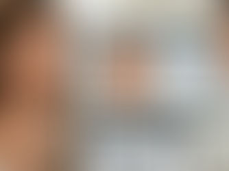 First-time Botox consultation in Santa Monica aesthetic clinic