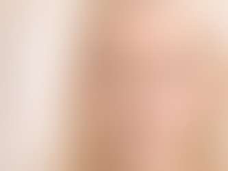 Botox for frown lines between eyebrows