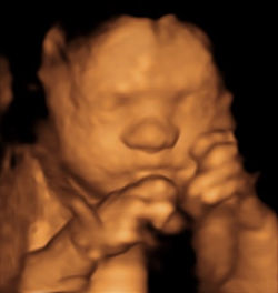 4D Ultrasound BabyScanUK