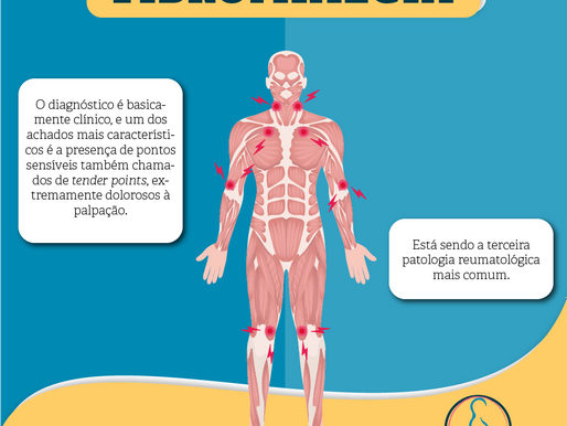 Fibromialgia