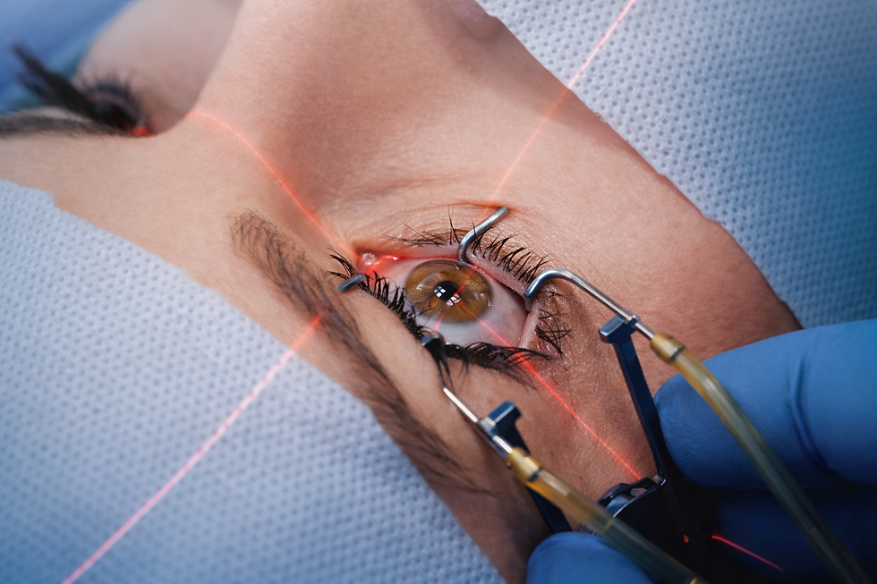 Cirurgia Refrativa a Laser: PRK, LASIK e SMILE