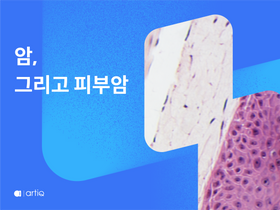 암, 그리고 피부암