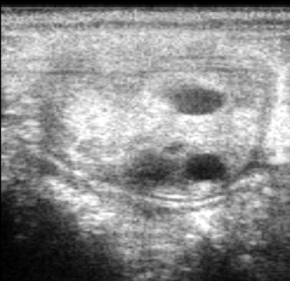 Preparation of Broodmares for Breeding Season - Part 4B: Reproductive Assessment (Technical)