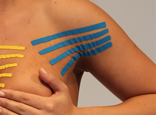 Dermotaping Breasts.png