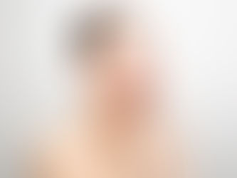 Woman with Dry Skin