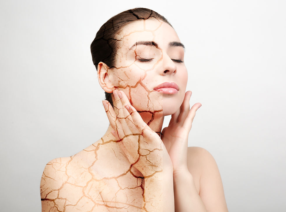 Woman With Dry Skin