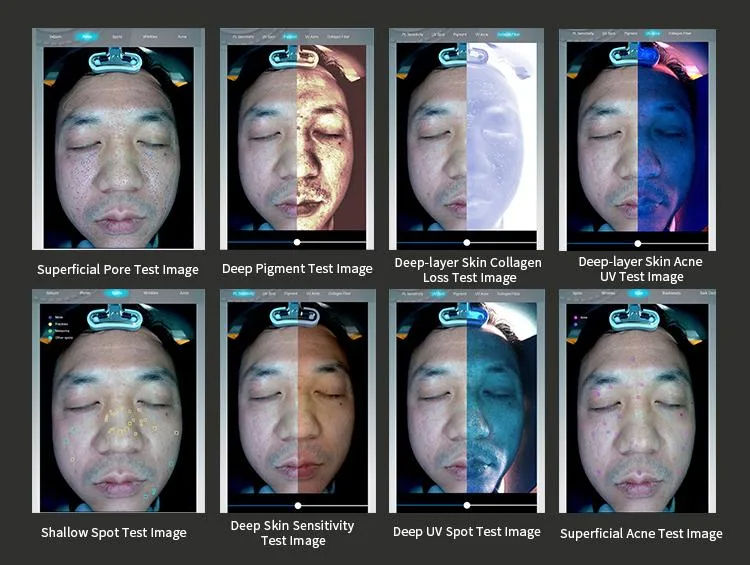 Küçük resim: Cilt Analiz Cihazı PRO