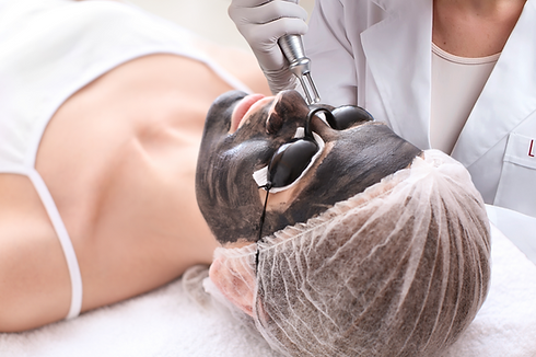 Spectra-Hollywood-Laser-Peel-1024x682.png