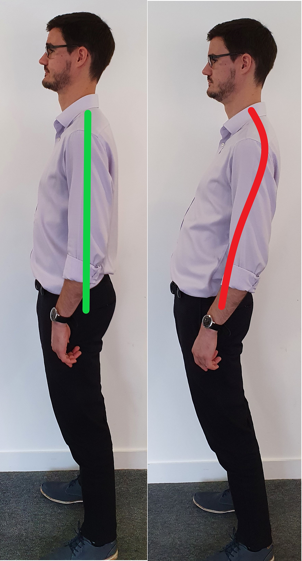 A man with a good straight posture and a man with a swayback posture showing that the pelvis shifts forwards and the upper back backwards.