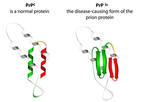 Diagnosis and Treatment Methods of Prion Diseases