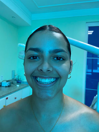 Cliente invisalign da Clínica Teresa Longo usando o aparelho e sorrindo