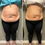 Thumbnail: Shape Shift - Body Sculpting Topical Fat Dissolve Cream