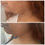 Thumbnail: Shape Shift - Body Sculpting Topical Fat Dissolve Cream